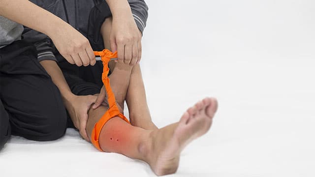 Bila terkena gigitan ular berbisa, ikat segera bagian atas dari titik gigitan