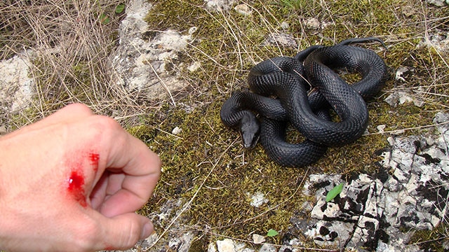 Jangan pernah menyedot luka gigitan ular