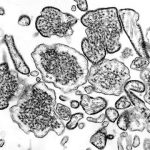 Ilustrasi virus Nipah. Foto: CDC