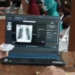 Ilustrasi pemeriksaan pasien TBC. Foto: Kemenkes